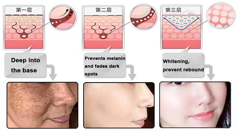 3 Ethyl Ascorbic Acid Whitening